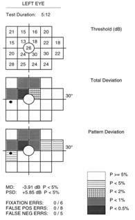 fdt test|frequency doubling perimetry.